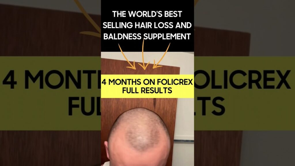 folicrex